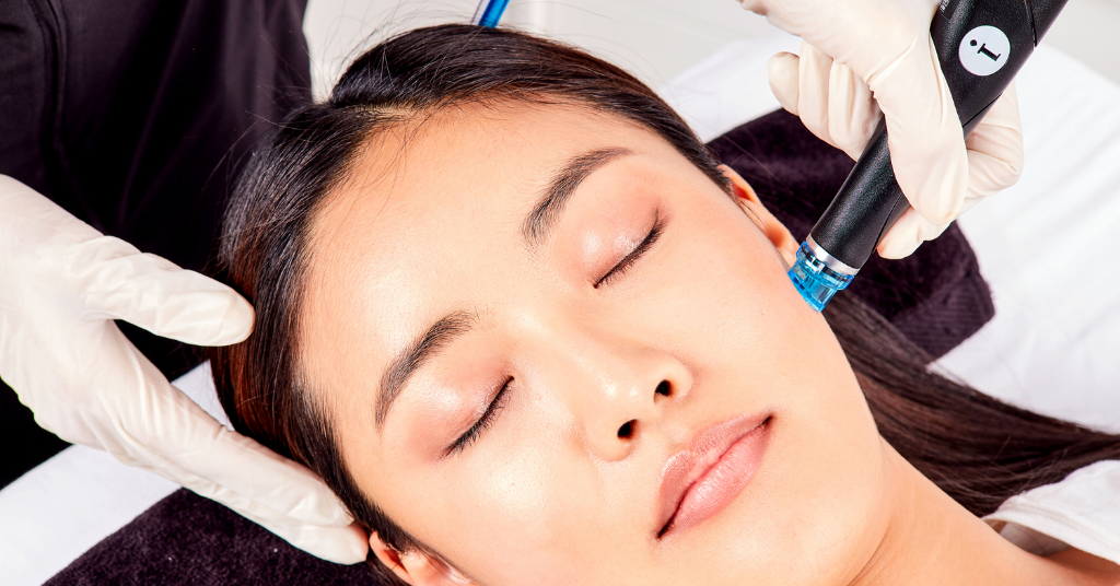 Introducing The Revolutionary HydraFacial at °CRYO UAE Centers!