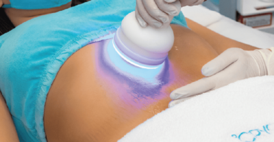cryo-slim-shop-offer-01-01-1