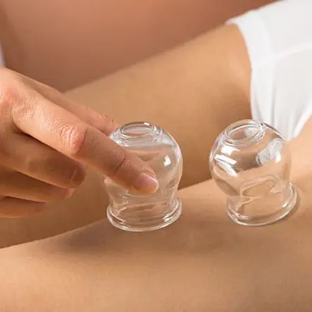 Cellulite Cupping